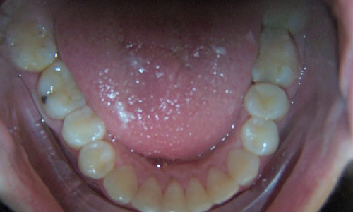 Patient smile after orthodontic treatment (case 21)
