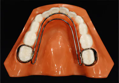 Frozat appliance