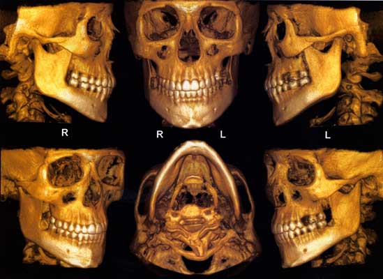 Three-dimensional cone-beam scan rendition of the dental-facial complex