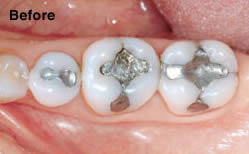 cerec-dentistry-b4