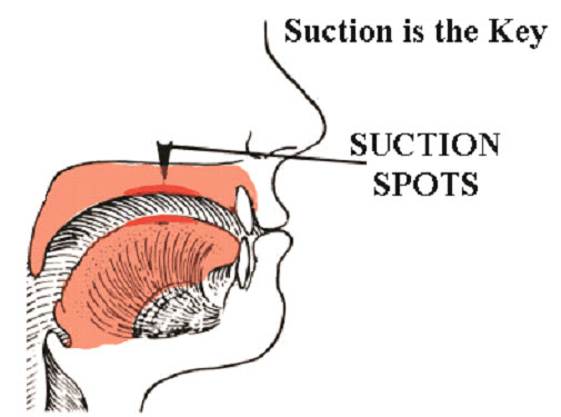 Sucked Tongue